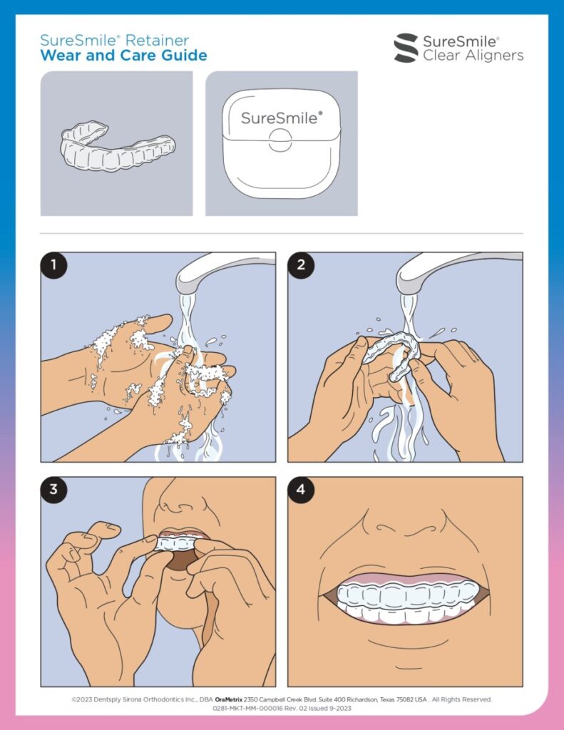 zubarski aparat, prozirne udlage, retencija, ortodontija, ispravljanje zuba, osmijeh, prozirni aligneri za ispravljanje zuba, najbolji prozirni aligneri, cijena nevidljivog aparatića, kako funkcioniraju prozirni aligneri, ortodont za prozirne alignere