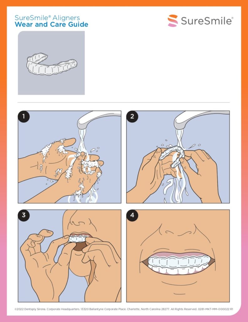 zubarski aparat, prozirne udlage, retencija, ortodontija, ispravljanje zuba, osmijeh, prozirni aligneri za ispravljanje zuba, najbolji prozirni aligneri, cijena nevidljivog aparatića, kako funkcioniraju prozirni aligneri, ortodont za prozirne alignere